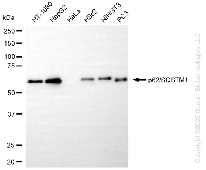 KD-Validated Anti-Sequestosome 1 Rabbit Monoclonal Antibody ABG1378
