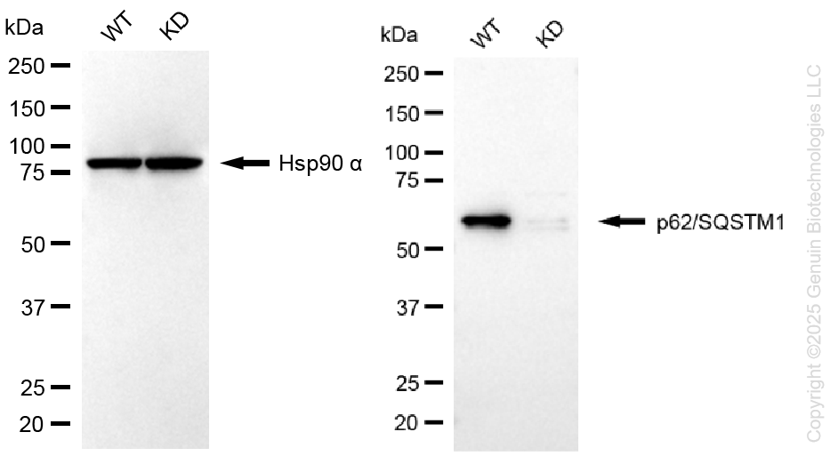 KD-Validated Anti-Sequestosome 1 Rabbit Monoclonal Antibody ABG1378