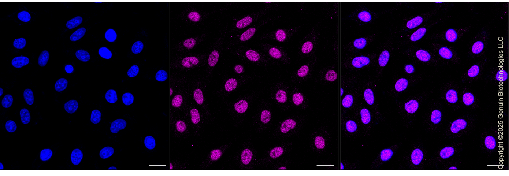 KD-Validated Anti-Transcription Factor 7 Like 2 Rabbit Monoclonal Antibody ABG1379