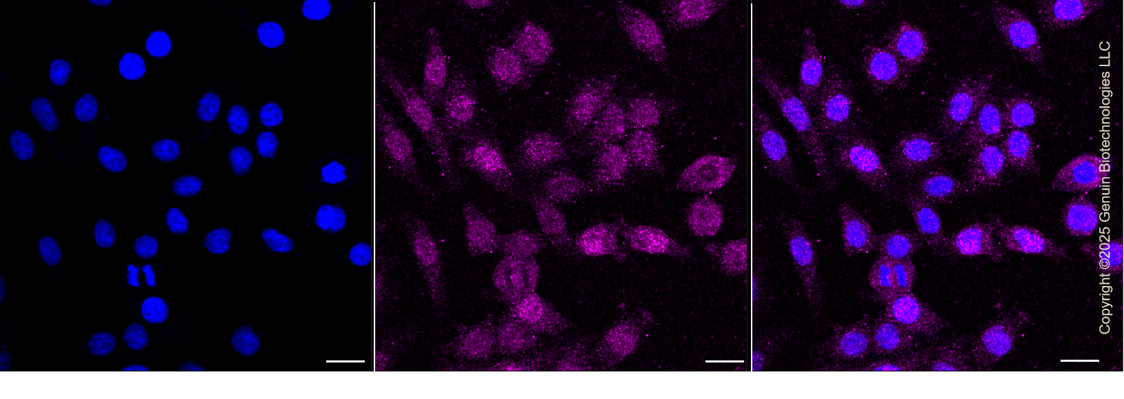 KD-Validated Anti-Thymidylate Synthase Rabbit Monoclonal Antibody ABG1380
