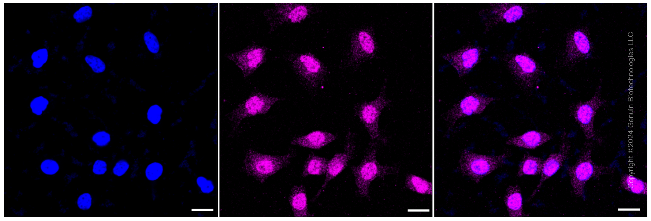 KD-Validated Anti-IQGAP2 Rabbit Monoclonal Antibody ABG1382