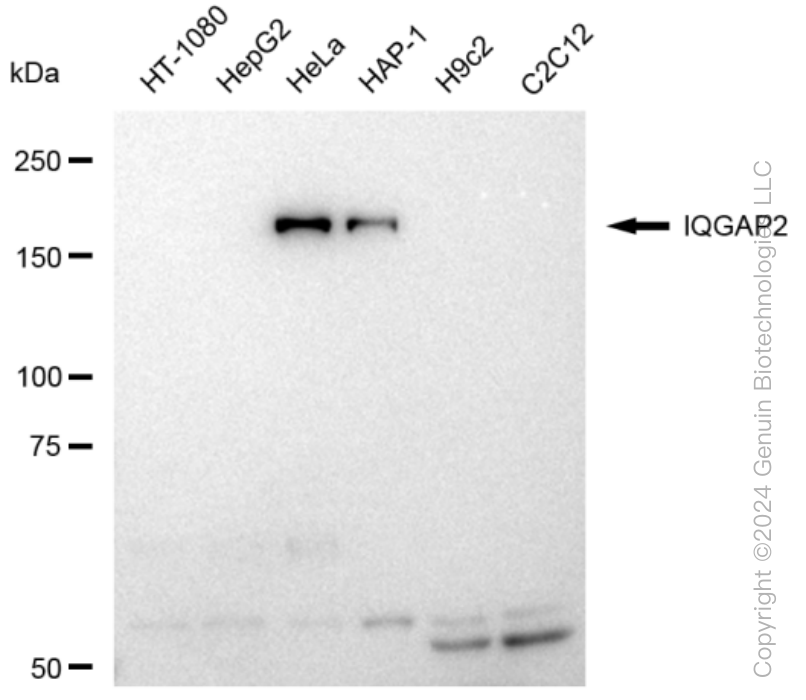 KD-Validated Anti-IQGAP2 Rabbit Monoclonal Antibody ABG1382