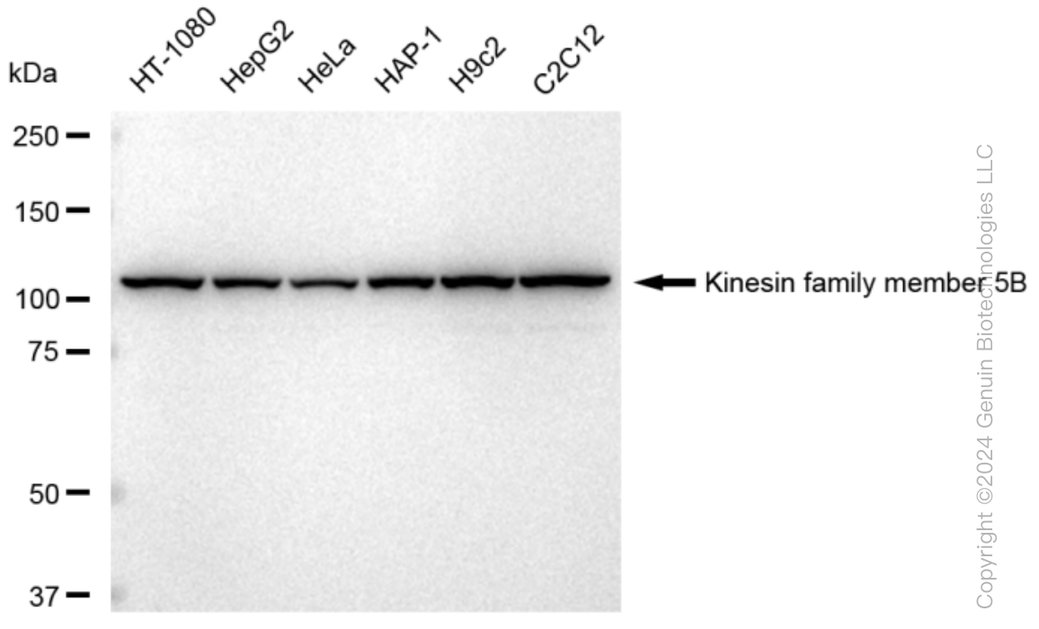 KD-Validated Anti-Kinesin family member 5B Rabbit Monoclonal Antibody ABG1383