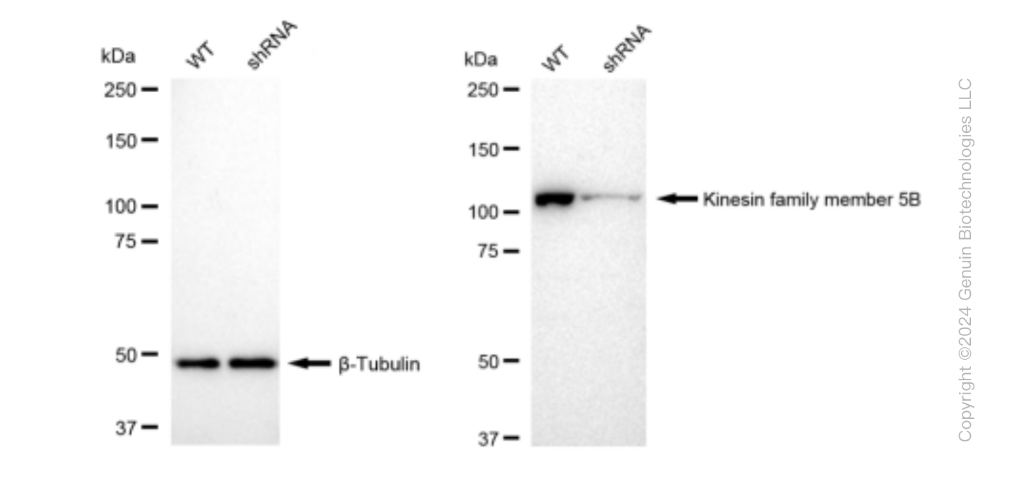 KD-Validated Anti-Kinesin family member 5B Rabbit Monoclonal Antibody ABG1383