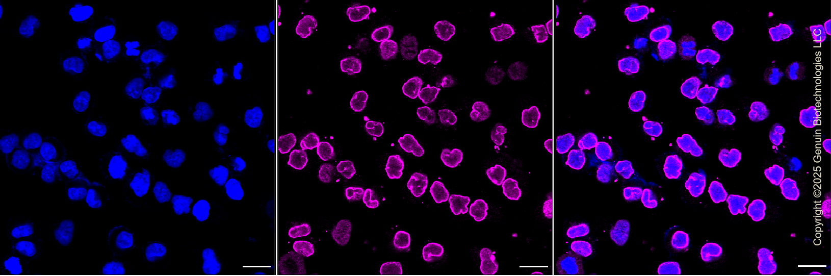 KD-Validated Anti-Ubiquitin Specific Peptidase 11 Rabbit Monoclonal Antibody ABG1386