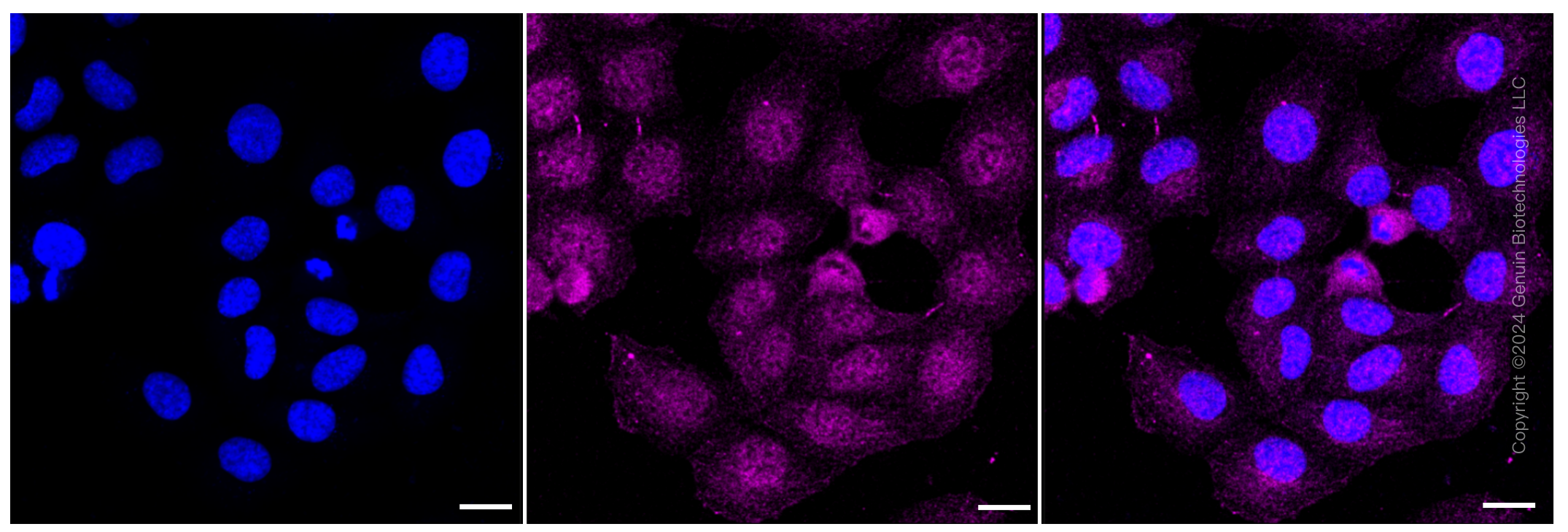 KD-Validated Anti-Oxysterol binding protein like 1A Rabbit Monoclonal Antibody ABG1389