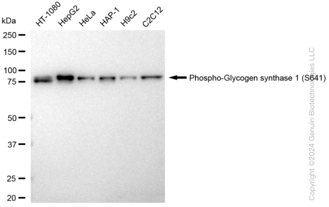 KD-Validated Anti-Phospho-Glycogen synthase 1 (S641) Rabbit Monoclonal Antibody ABG1390