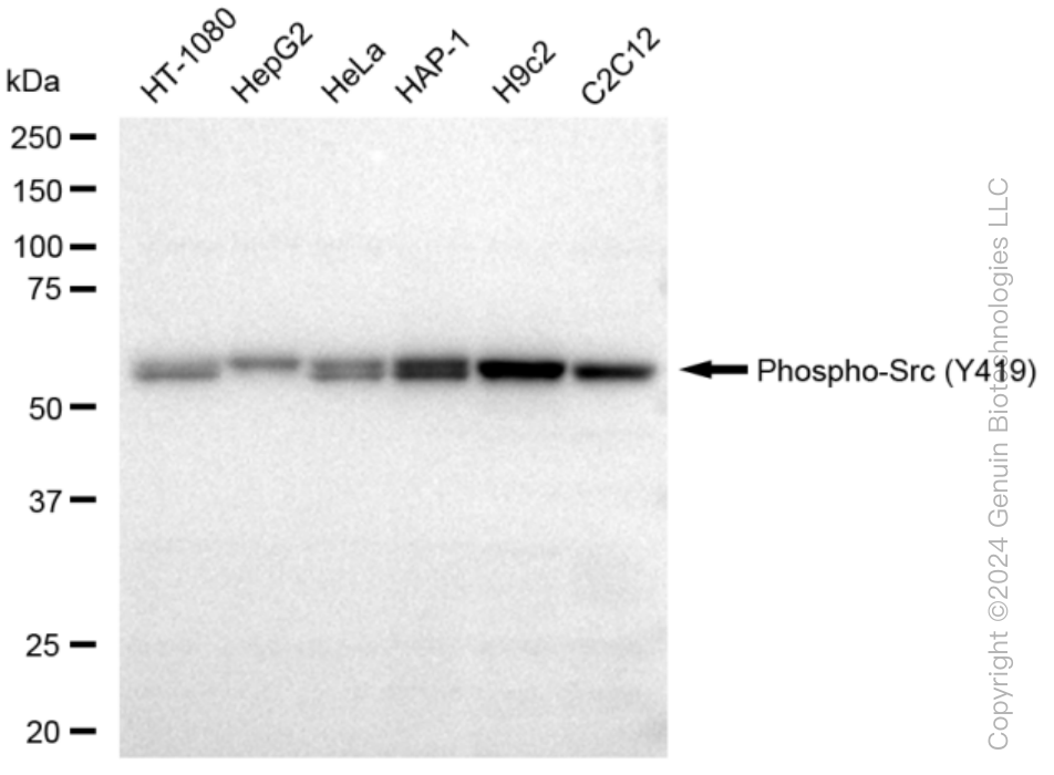 KD-Validated Anti-Phospho-Src (Y419) Rabbit Monoclonal Antibody ABG1391