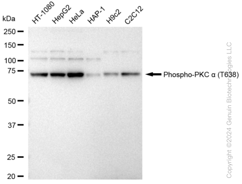 KD-Validated Anti-Phospho-PKC alpha (T638) Rabbit Monoclonal Antibody ABG1392