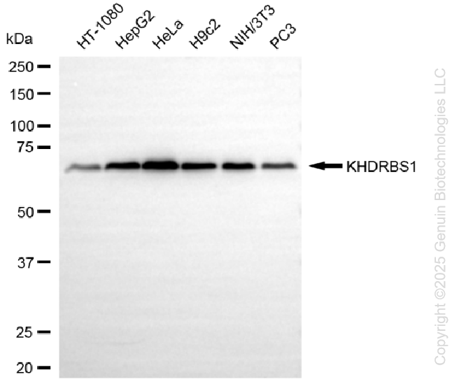 KD-Validated Anti-KHDRBS1 Rabbit Monoclonal Antibody ABG1393