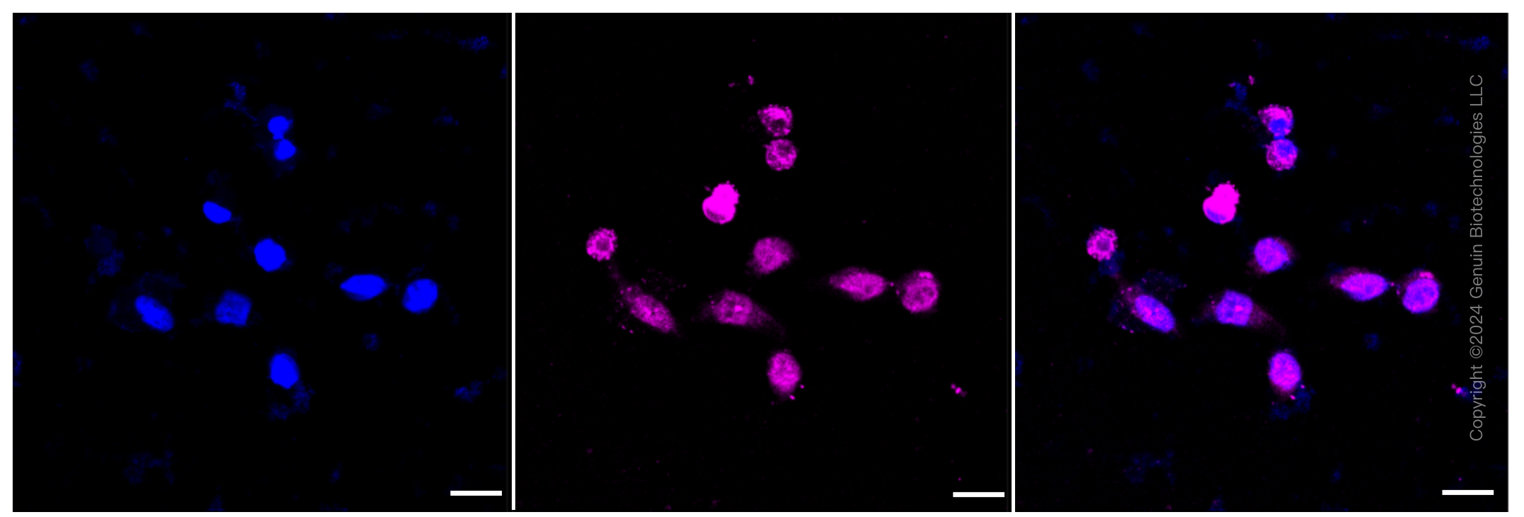 KD-Validated Anti-RAD50 Rabbit Monoclonal Antibody ABG1395