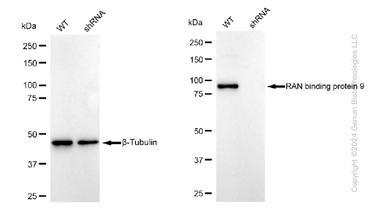 KD-Validated Anti-RAN binding protein 9 Rabbit Monoclonal Antibody ABG1396