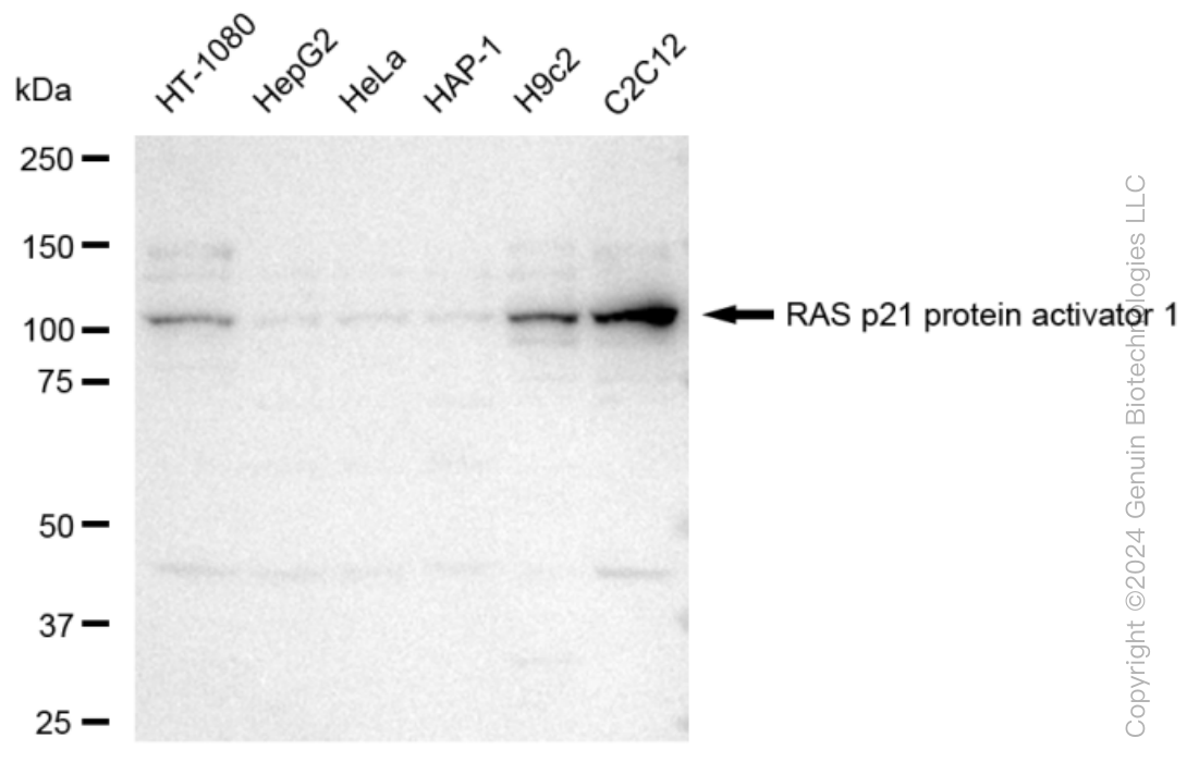 KD-Validated Anti-RAS p21 protein activator 1 Rabbit Monoclonal Antibody ABG1397