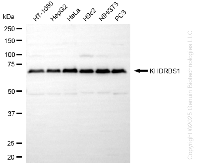KD-Validated Anti-KHDRBS1 Rabbit Monoclonal Antibody ABG1400