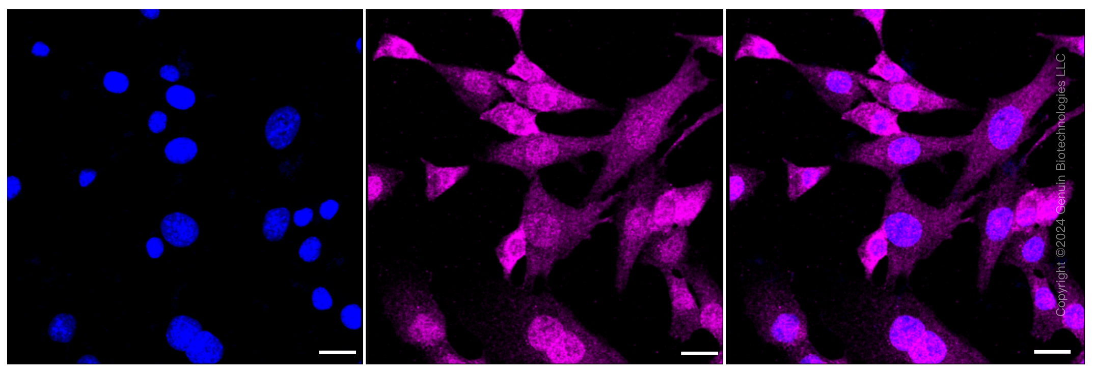 KD-Validated Anti-Phospho-Smad2 (S250) Rabbit Monoclonal Antibody ABG1401