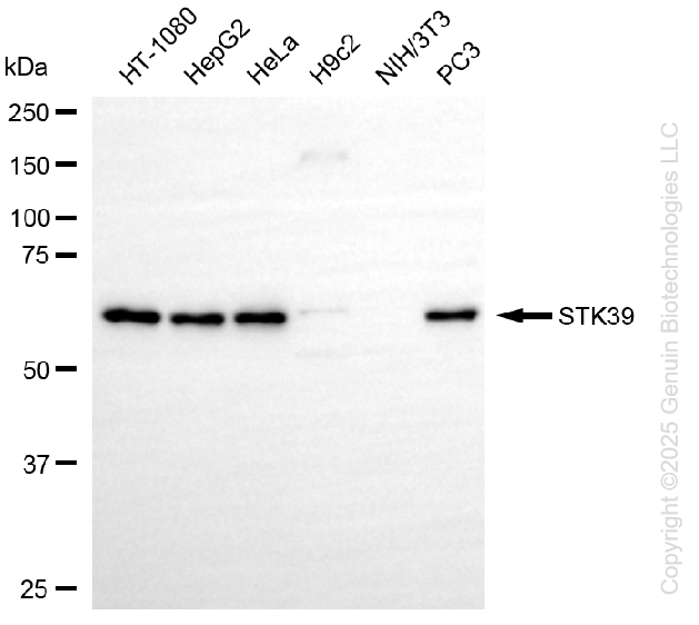 KD-Validated Anti-Serine/Threonine Kinase 39 Rabbit Monoclonal Antibody ABG1403