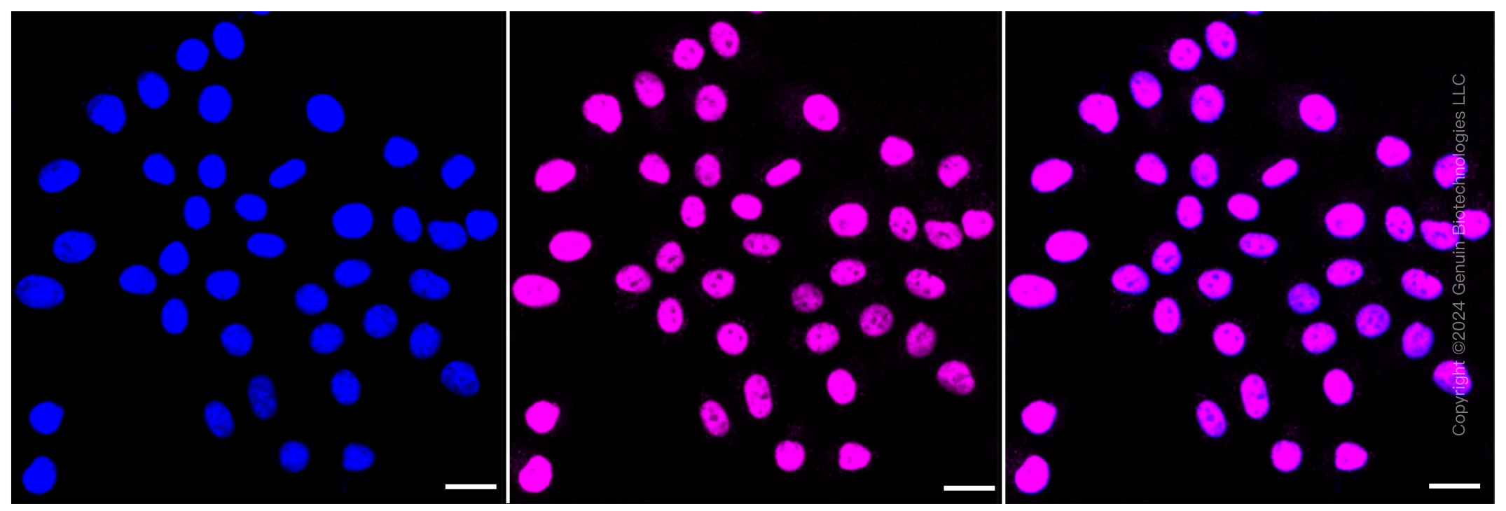 KD-Validated Anti-SMARCC1 Rabbit Monoclonal Antibody ABG1404