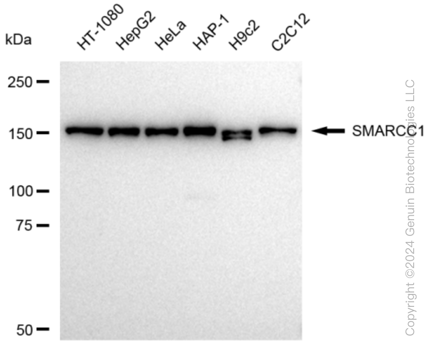 KD-Validated Anti-SMARCC1 Rabbit Monoclonal Antibody ABG1404