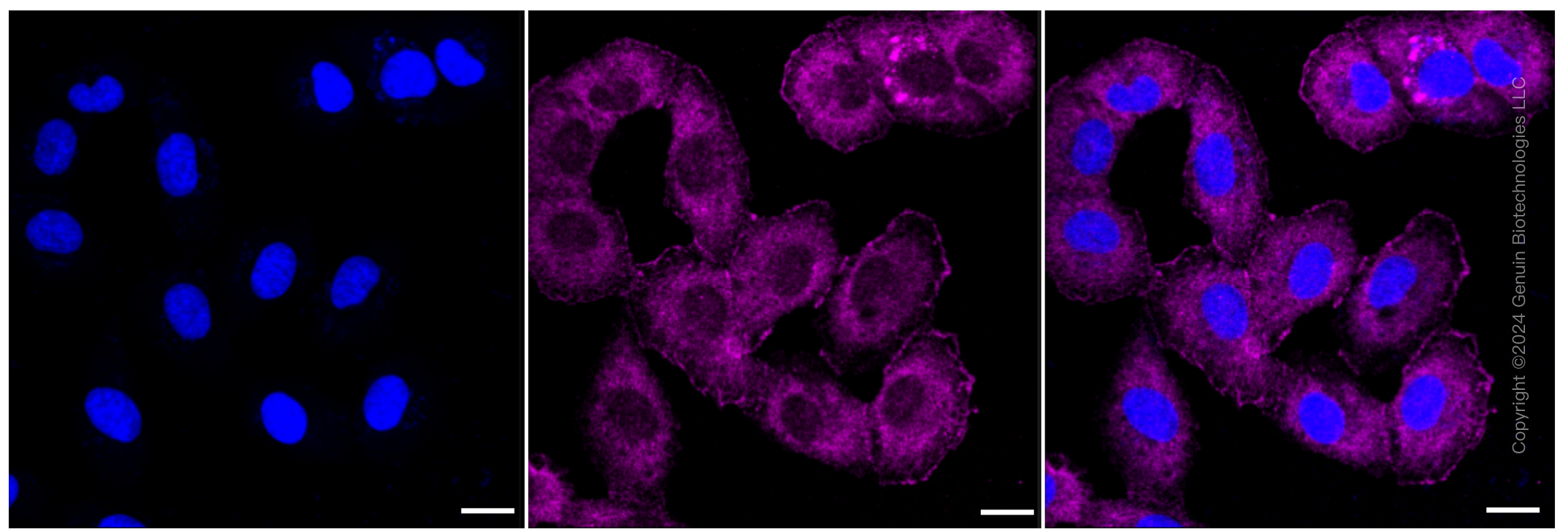 KD-Validated Anti-SPINK5 Rabbit Monoclonal Antibody ABG1407