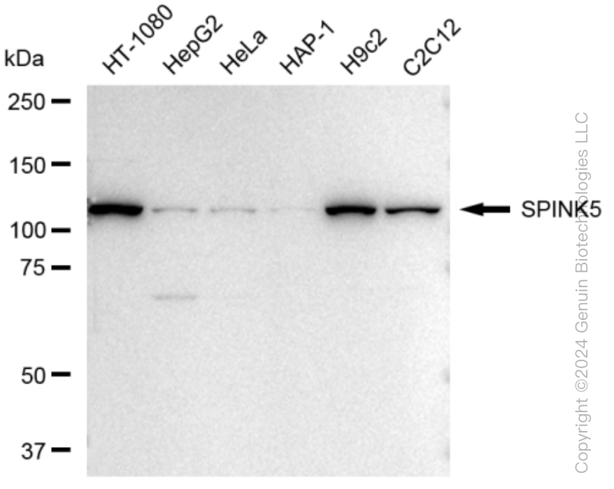KD-Validated Anti-SPINK5 Rabbit Monoclonal Antibody ABG1407