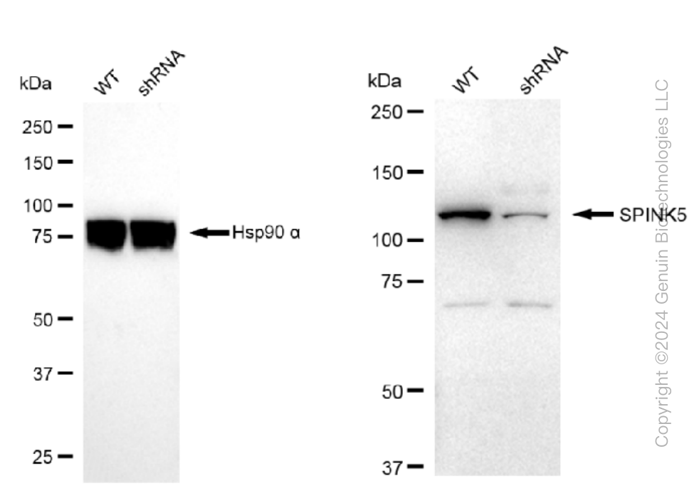 KD-Validated Anti-SPINK5 Rabbit Monoclonal Antibody ABG1407