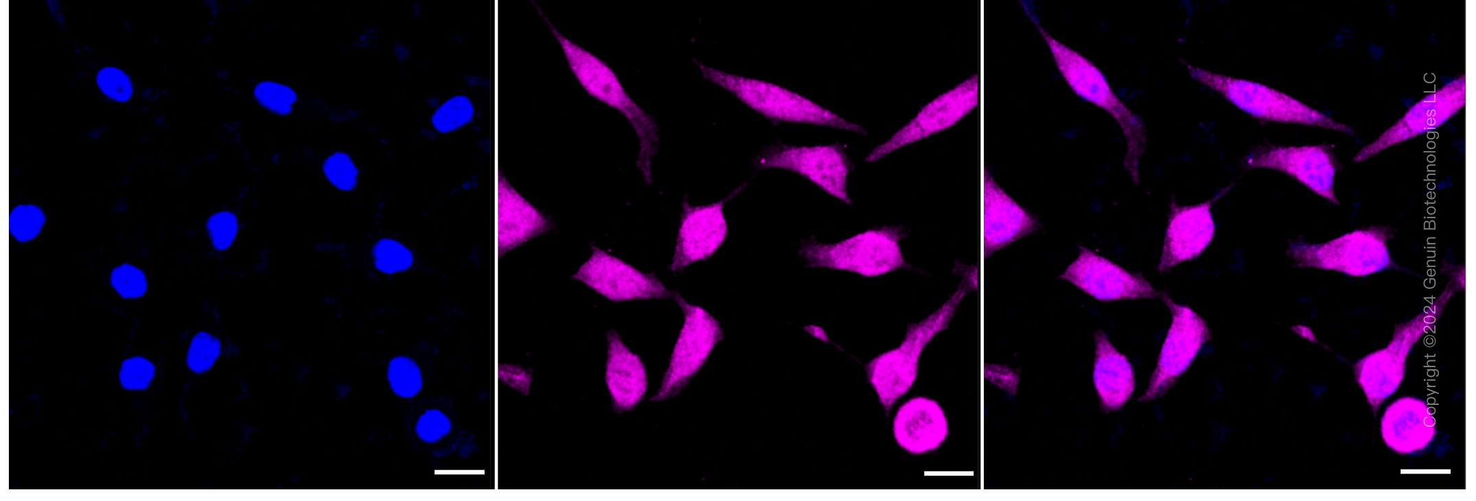 KD-Validated Anti-STAT1 Rabbit Monoclonal Antibody ABG1408