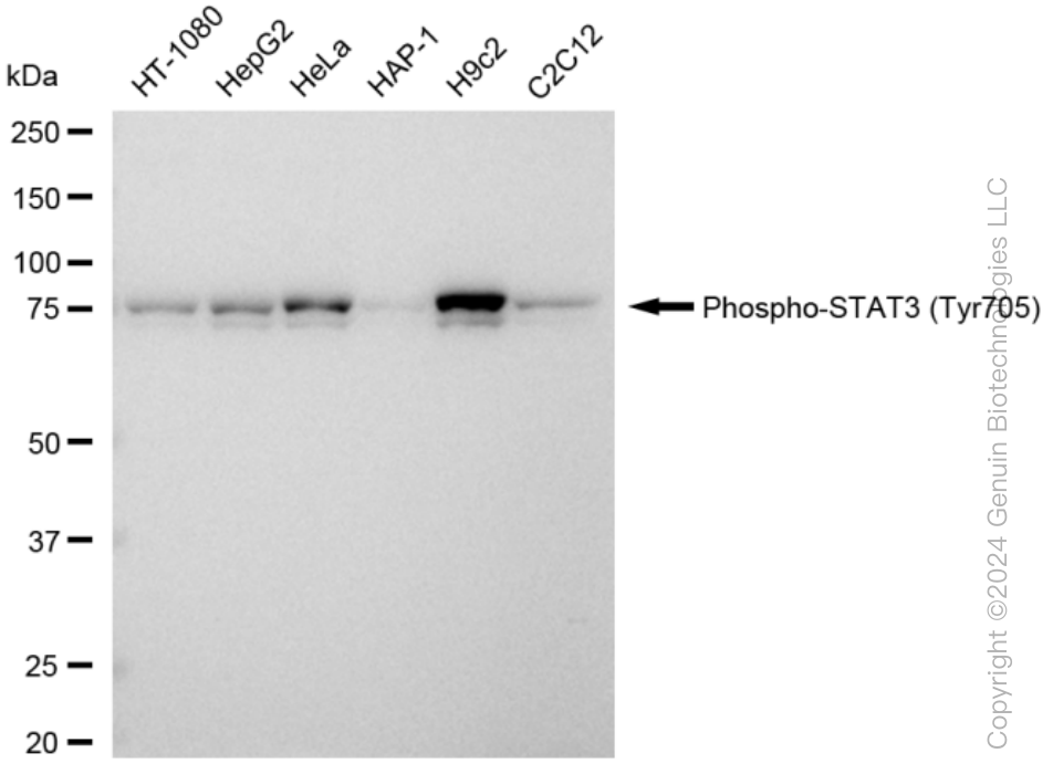 KD-Validated Anti-Phospho-STAT3 (Tyr705) Rabbit Monoclonal Antibody ABG1411