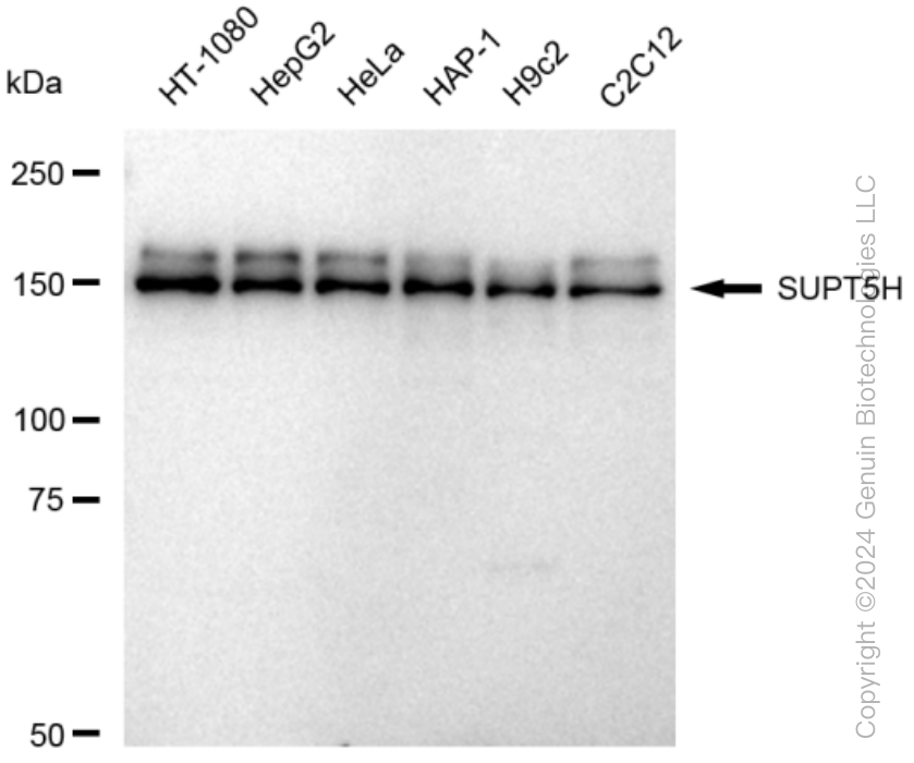 KD-Validated Anti-SUPT5H Rabbit Monoclonal Antibody ABG1413