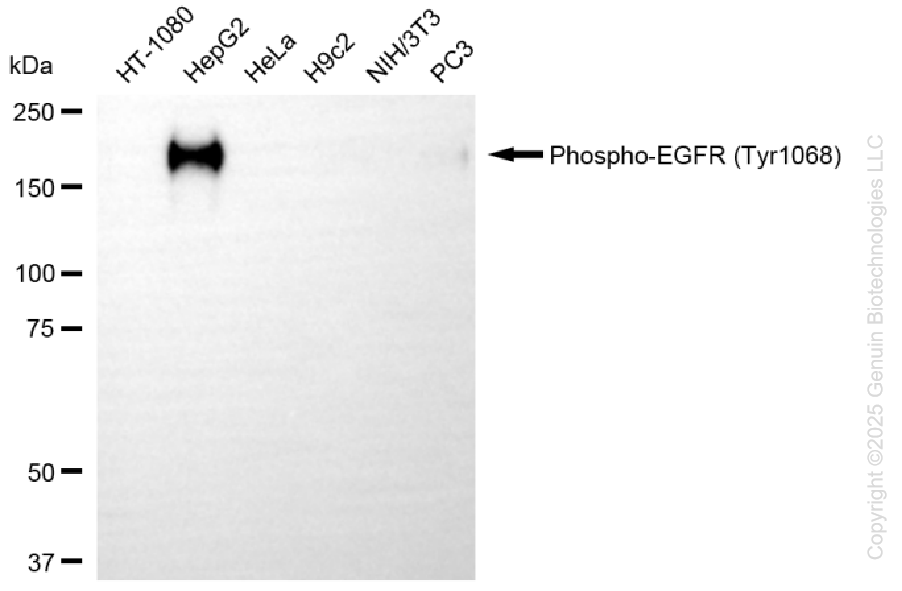 KD-Validated Anti-Phospho-EGFR (Tyr1068) Rabbit Monoclonal Antibody ABG1414