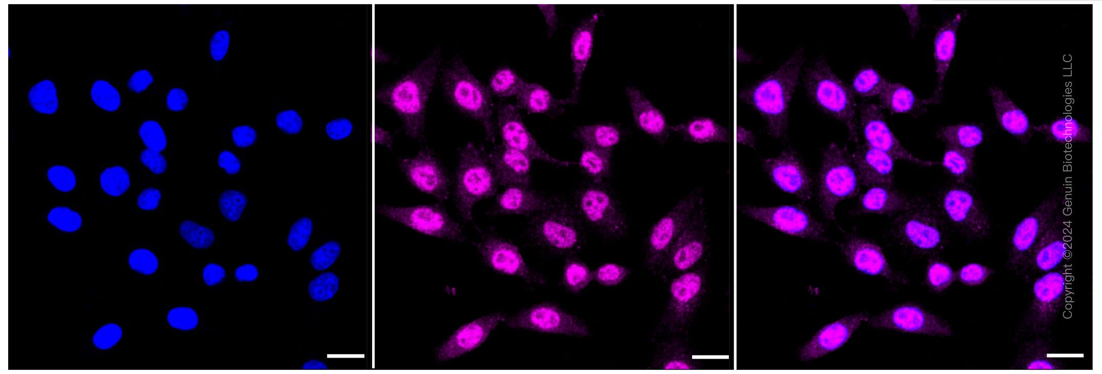 KD-Validated Anti-Ubiquitin specific peptidase 13 Rabbit Monoclonal Antibody ABG1417