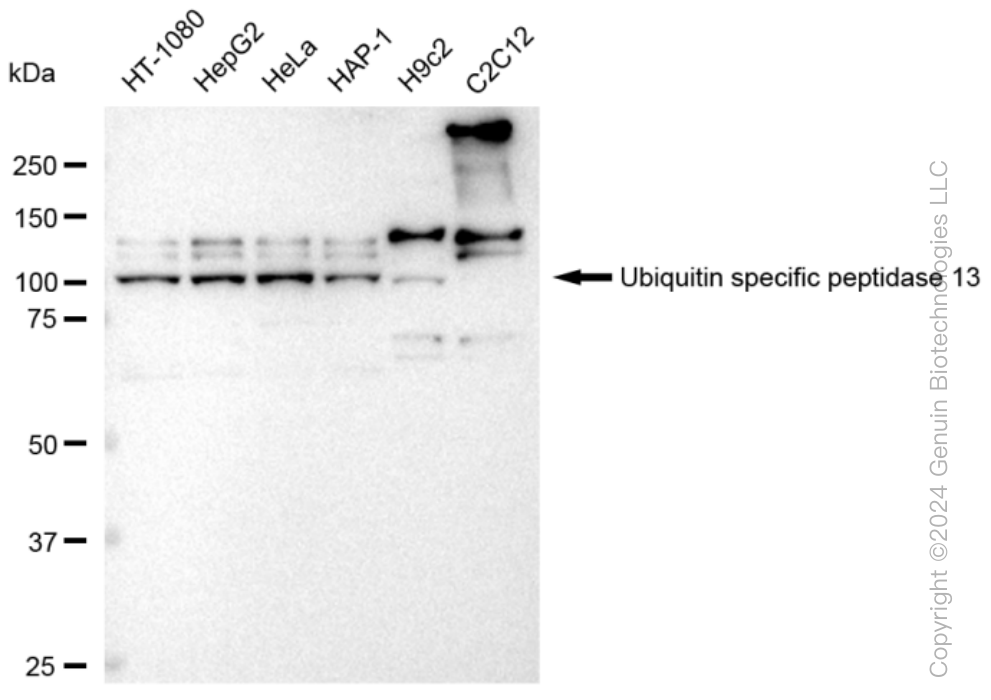 KD-Validated Anti-Ubiquitin specific peptidase 13 Rabbit Monoclonal Antibody ABG1417