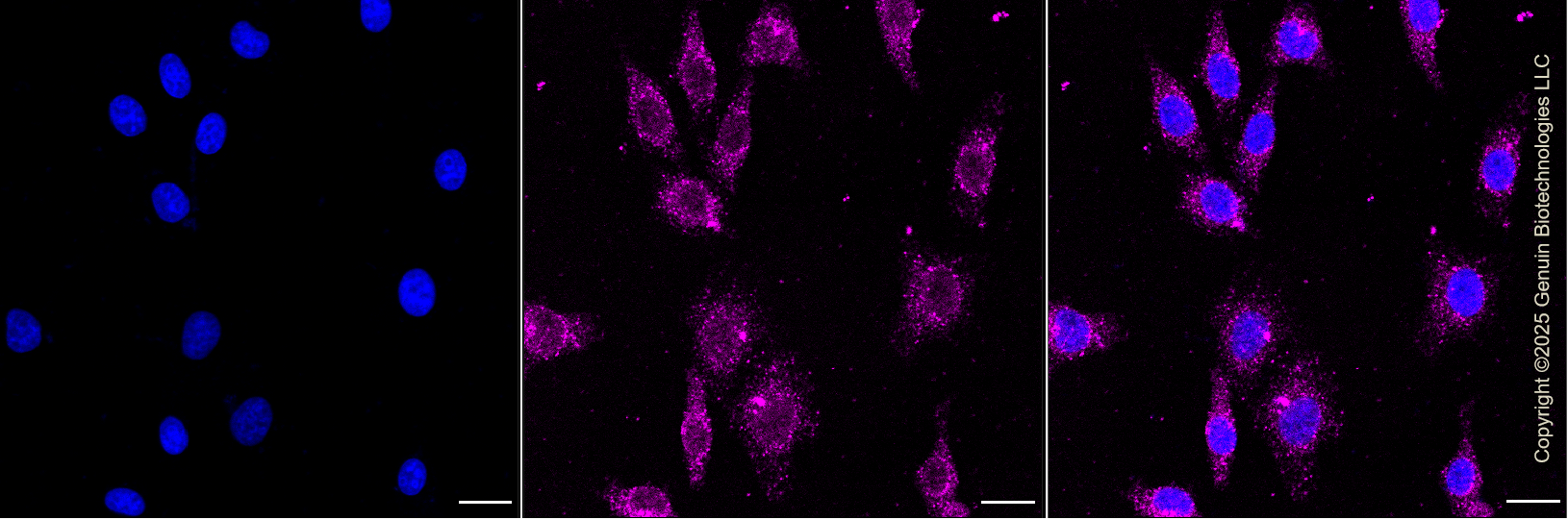 KD-Validated Anti-ROCK1 Rabbit Monoclonal Antibody ABG1418