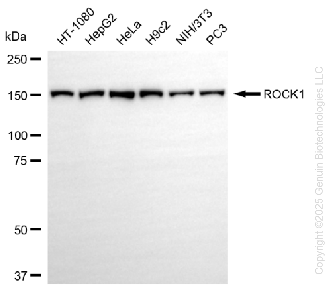 KD-Validated Anti-ROCK1 Rabbit Monoclonal Antibody ABG1418