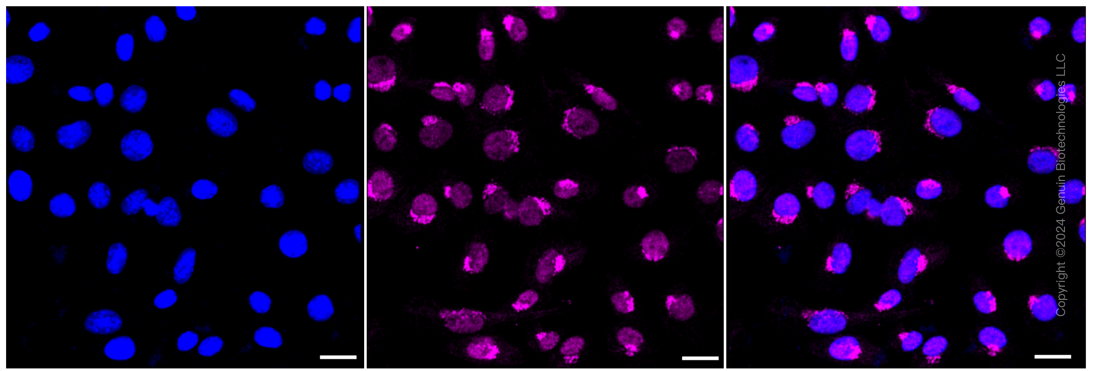 KD-Validated Anti-VPS35 Rabbit Monoclonal Antibody ABG1419