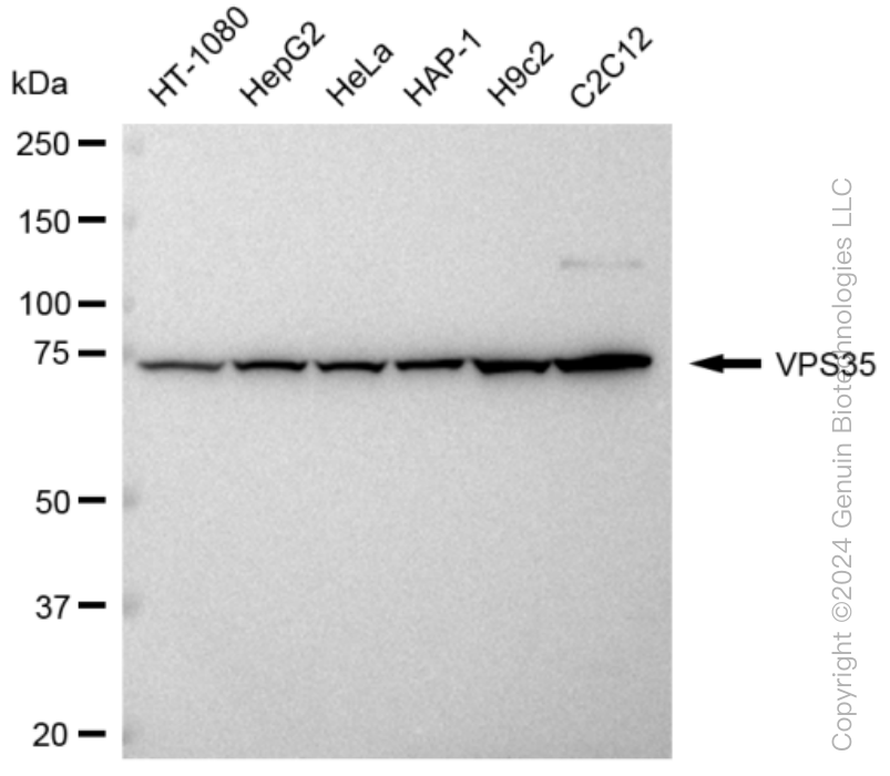 KD-Validated Anti-VPS35 Rabbit Monoclonal Antibody ABG1419