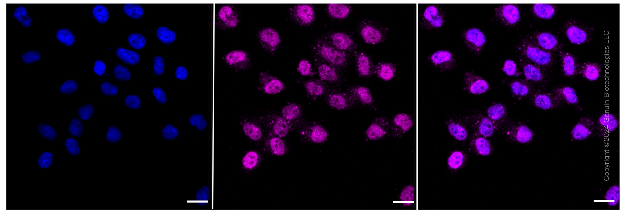 KD-Validated Anti-CD147 Rabbit Monoclonal Antibody ABG1420