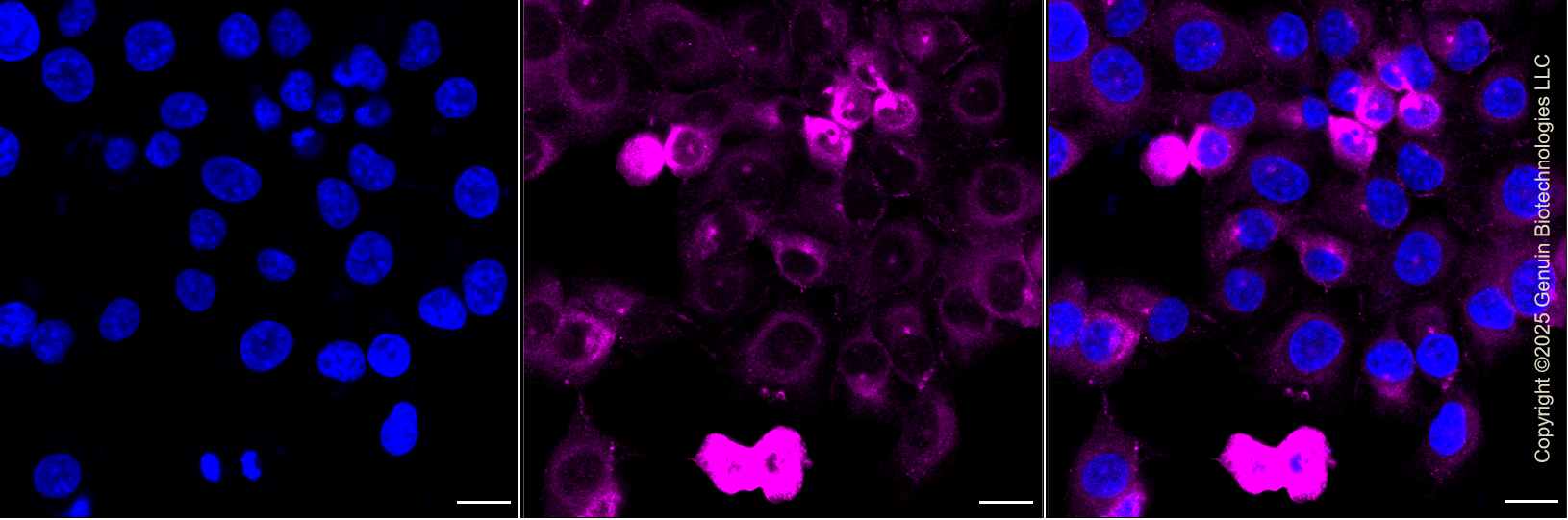 KD-Validated Anti-Phospho-Vimentin (Ser72) Rabbit Monoclonal Antibody ABG1422