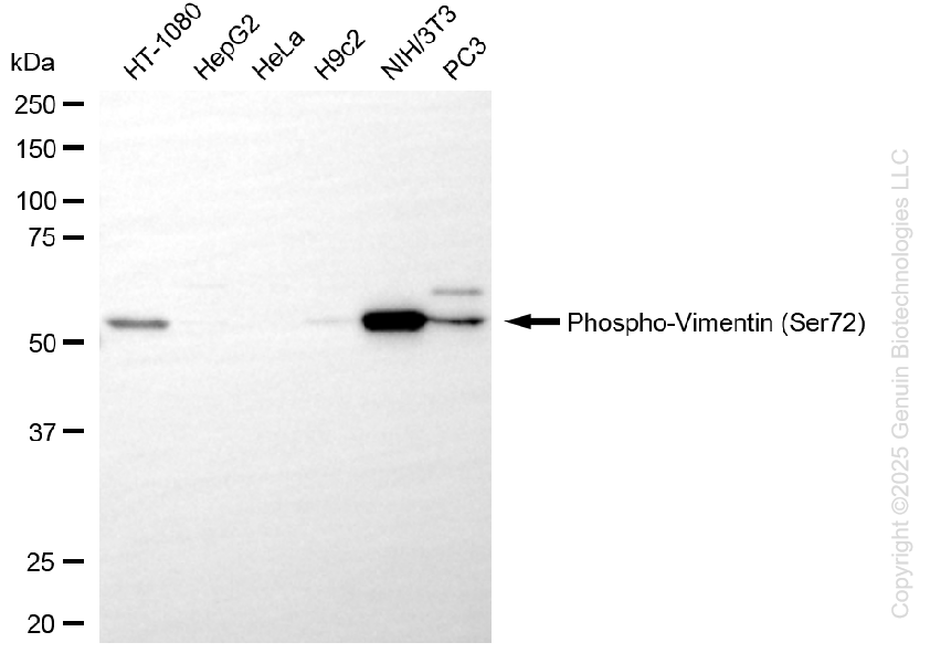 KD-Validated Anti-Phospho-Vimentin (Ser72) Rabbit Monoclonal Antibody ABG1422