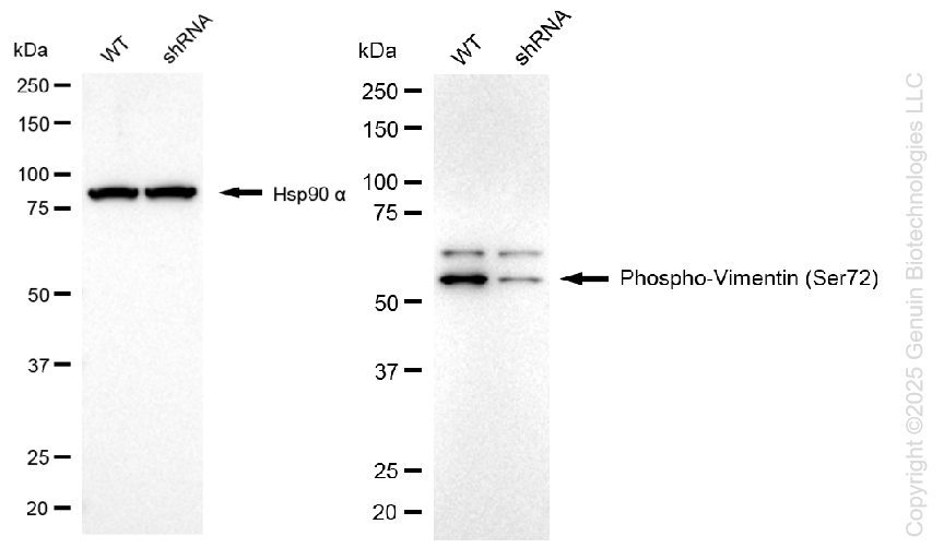 KD-Validated Anti-Phospho-Vimentin (Ser72) Rabbit Monoclonal Antibody ABG1422