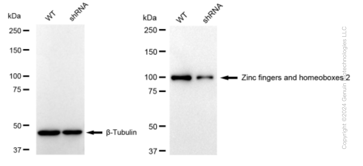 KD-Validated Anti-Zinc fingers and homeoboxes 2 Rabbit Monoclonal Antibody ABG1423