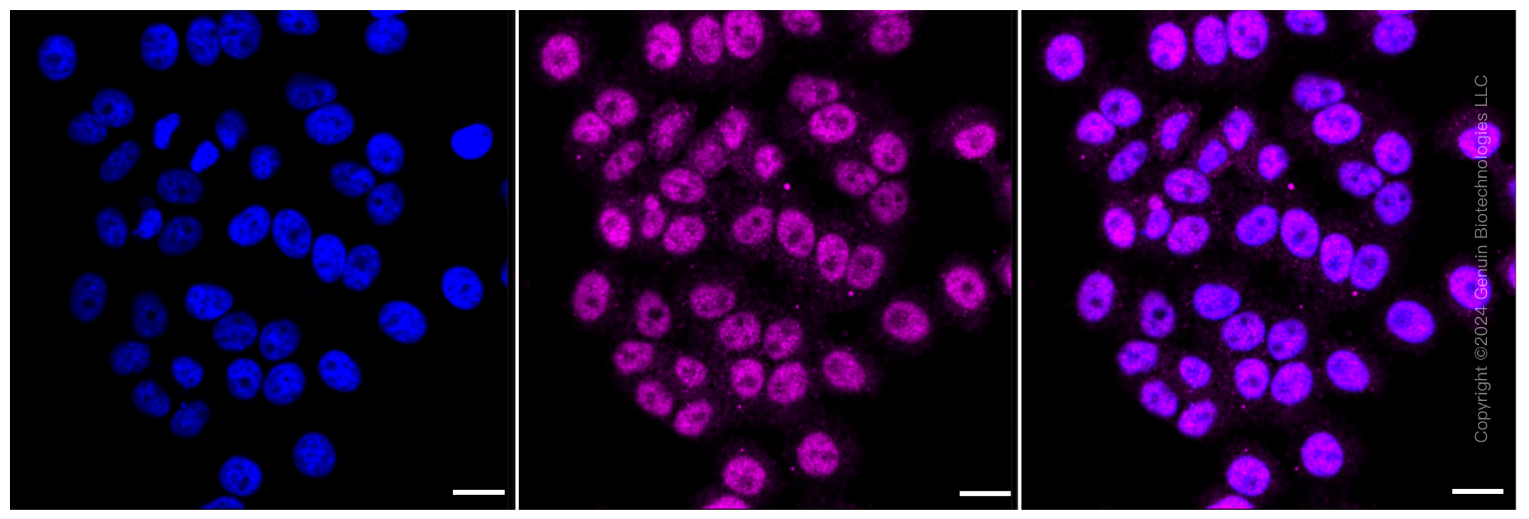 KD-Validated Anti-ATG5 Rabbit Monoclonal Antibody ABG1424