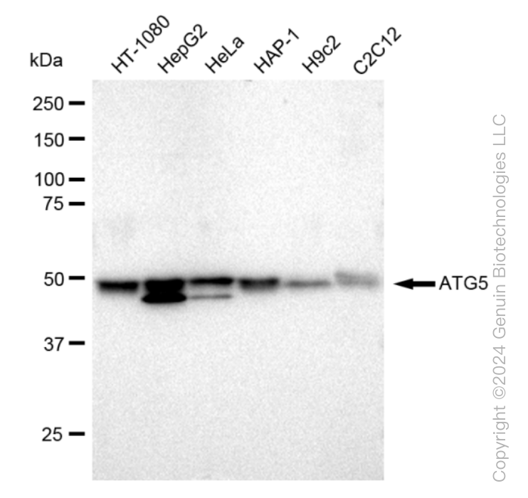 KD-Validated Anti-ATG5 Rabbit Monoclonal Antibody ABG1424