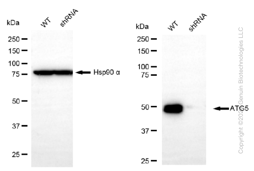 KD-Validated Anti-ATG5 Rabbit Monoclonal Antibody ABG1424