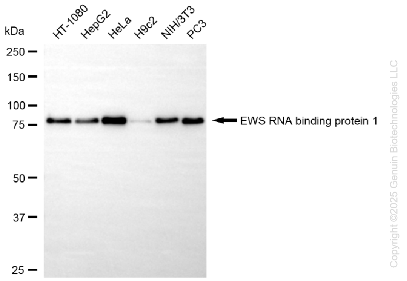 KD-Validated Anti-EWS RNA Binding Protein 1 Rabbit Monoclonal Antibody ABG1426