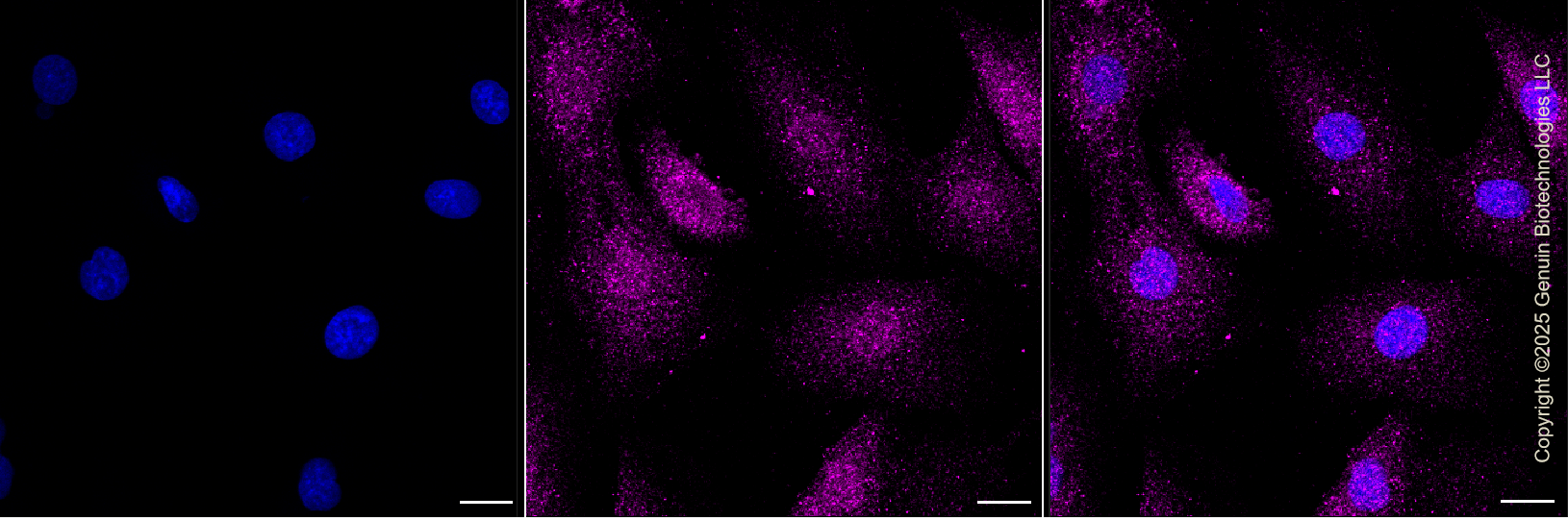 KD-Validated Anti-MAP1LC3B Rabbit Monoclonal Antibody ABG1428