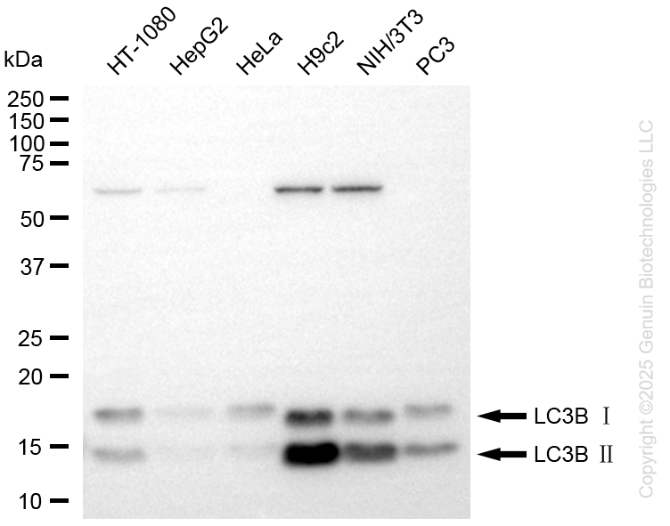 KD-Validated Anti-MAP1LC3B Rabbit Monoclonal Antibody ABG1428