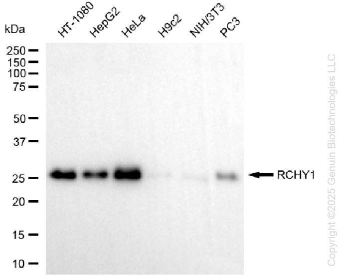 KD-Validated Anti-RCHY1 Rabbit Monoclonal Antibody ABG1430