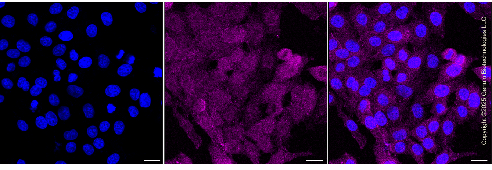 KD-Validated Anti-Thymidine Kinase 1 Rabbit Monoclonal Antibody ABG1431