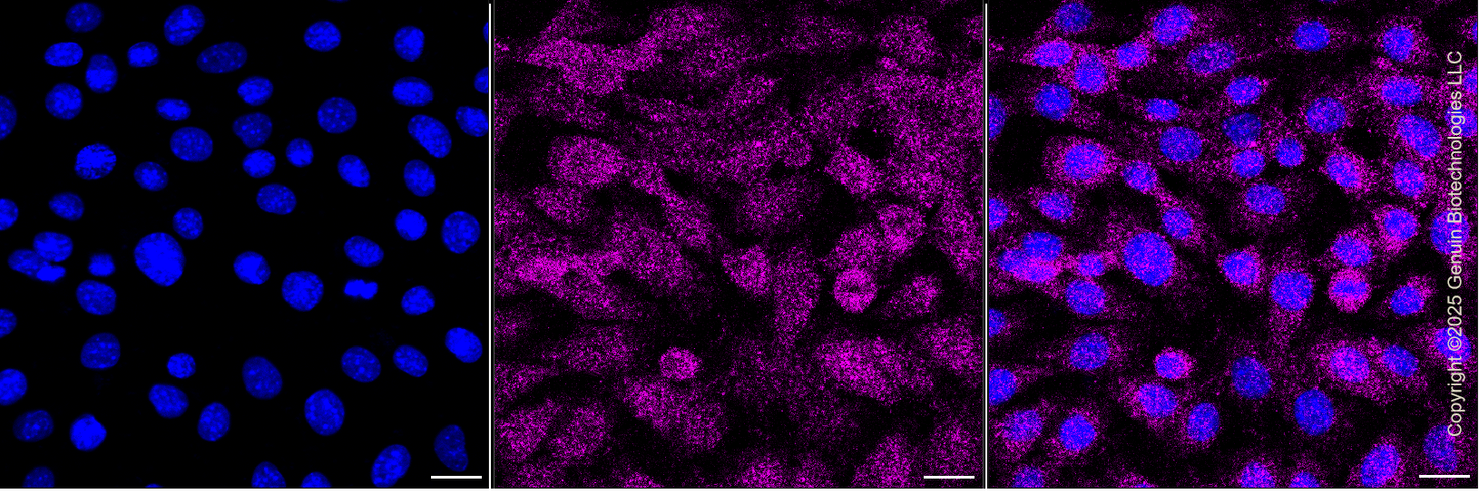 KD-Validated Anti-AKT3 Mouse Monoclonal Antibody ABG1438