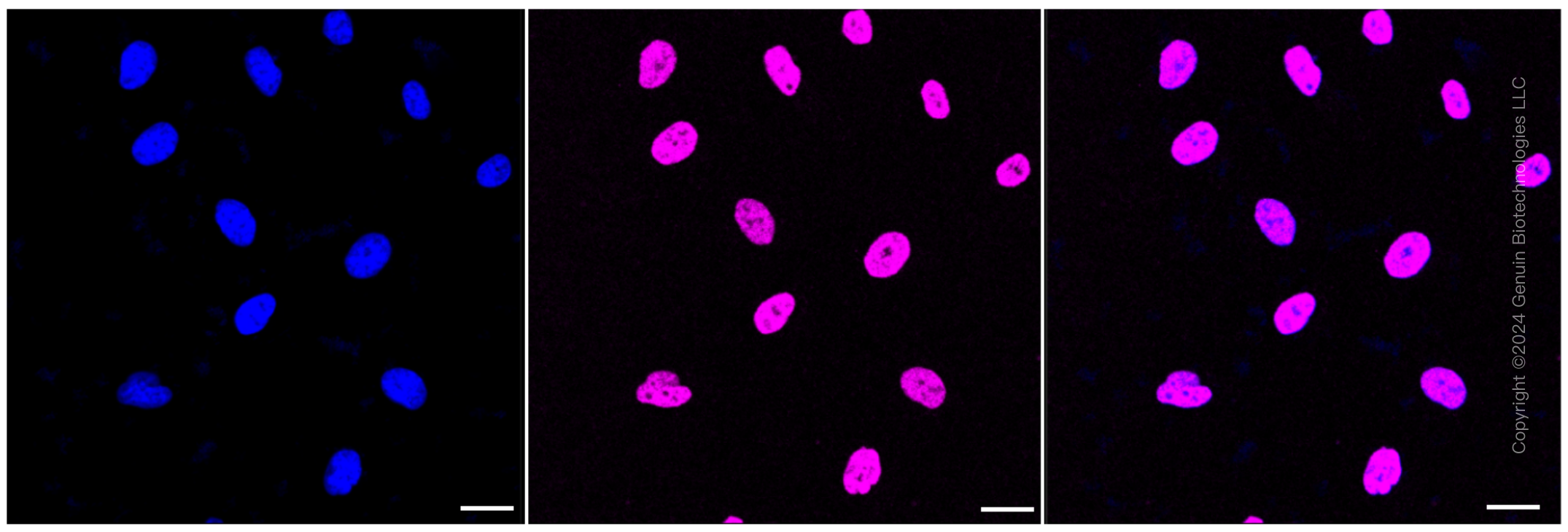 KD-Validated Anti-Histone H3 (acetyl K27) Rabbit Monoclonal Antibody ABG1445